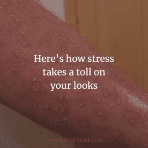stress and skin